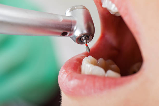 Best Emergency Dental Surgery in Ashland, OR